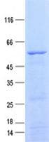 Human UQCC1/ UQCC Protein (Recombinant GST, N-terminus + His, C-terminus)