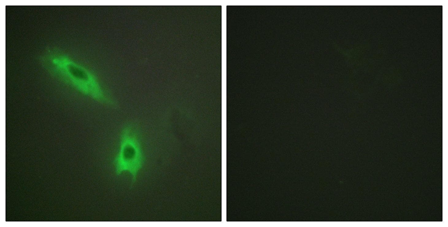 Lymphotoxin-Beta / LTB Antibody