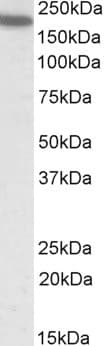 IHC-plus™ ITGAL / CD11a Antibody (aa953-965)