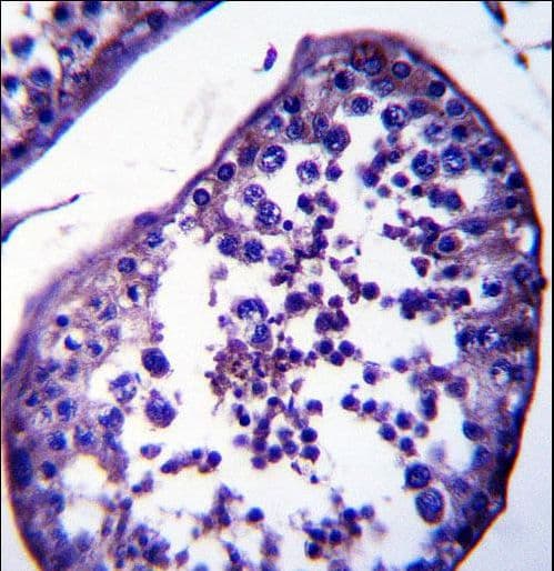 Polyclonal Rabbit anti-Human SPATA18 / MIEAP Antibody (aa92-120, IHC, WB)