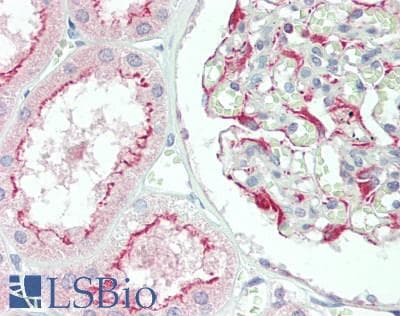 IHC-plus™ ITPR3 Antibody (aa1755-1825)
