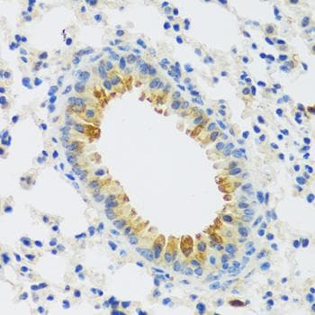 CAMK1 / CAMKI Antibody