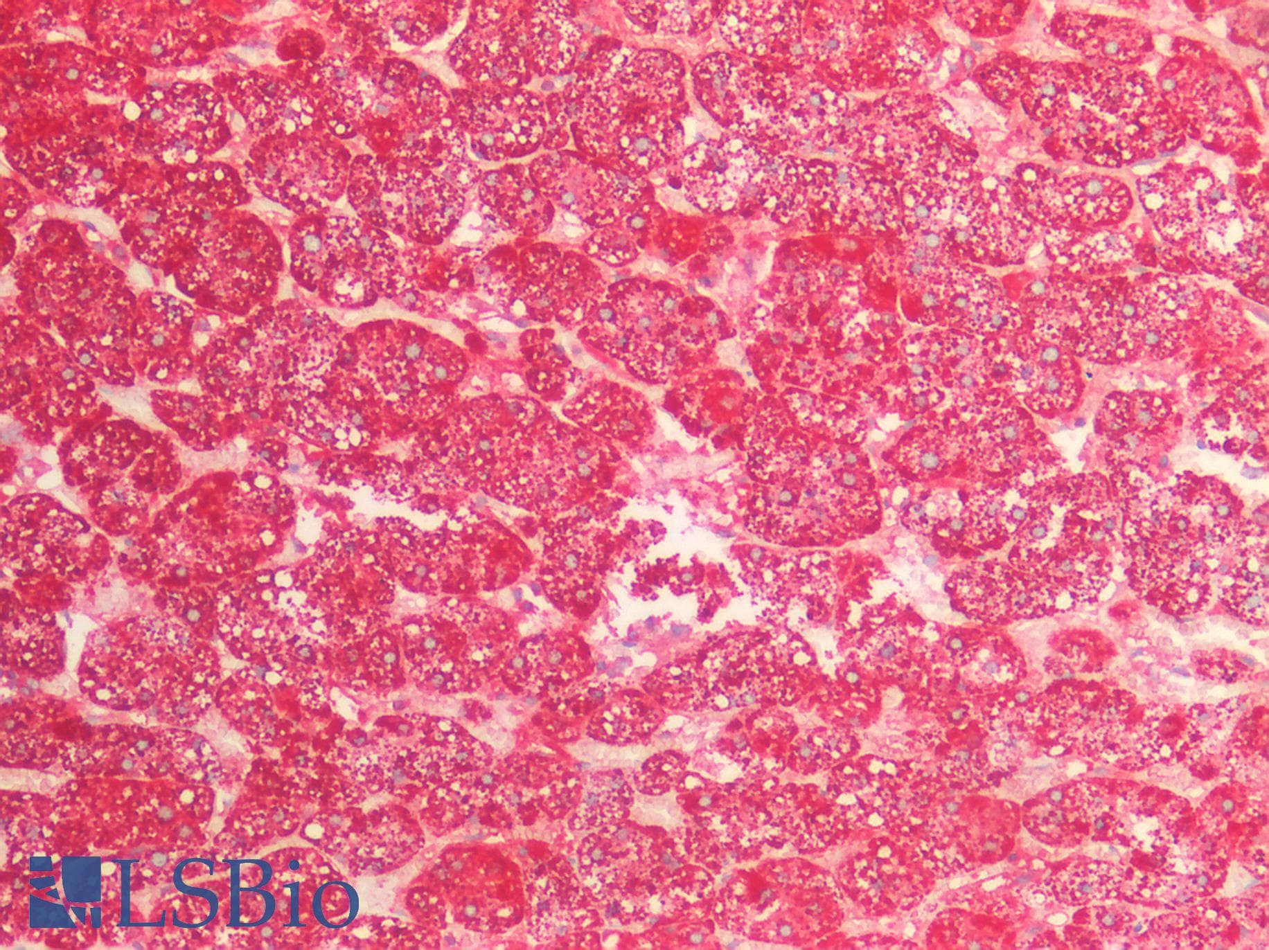 IHC-plus™ Polyclonal Goat anti-Human HSPE1 / HSP10 / Chaperonin 10 Antibody (IHC, WB)