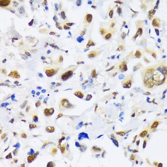 Polyclonal Rabbit anti-Human EP300 / p300 Antibody (IHC)
