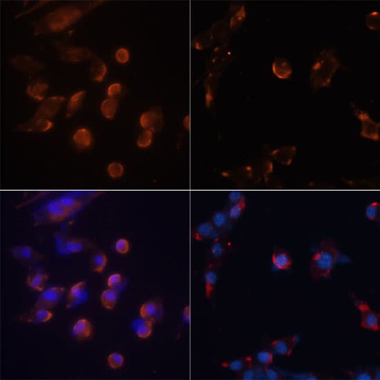 Polyclonal Rabbit anti-Human MAP1LC3B / LC3B Antibody (IHC, IF, WB)