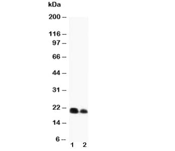 Polyclonal Rabbit anti-Rat IL6 / Interleukin 6 Antibody (aa195-211, WB)