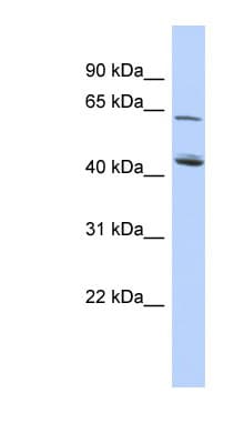 NADK2 / C5orf33 Antibody (aa215-264)