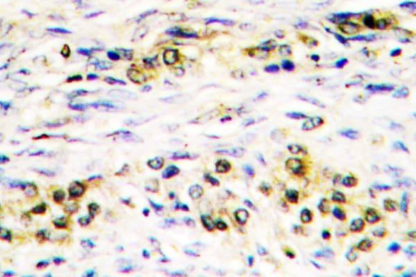 AKT1 + AKT2 + AKT3 Antibody (Pro470)