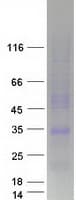 Human LEPROTL1 Protein (Recombinant Myc-DDK (Flag))
