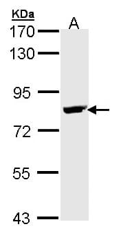 IHC-plus™ BTK Antibody