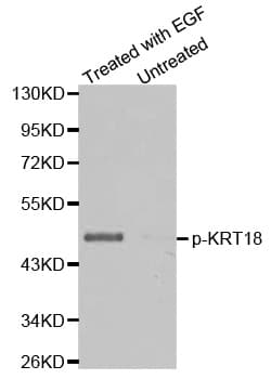 KRT18 / CK18 / Cytokeratin 18 Antibody (phospho-Ser33)