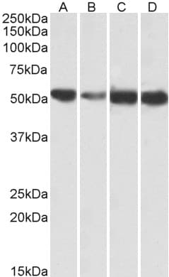 IHC-plus™ Polyclonal Goat anti-Human ATP5A1 / ATP Synthase Alpha Antibody (aa83-94, IHC, WB)