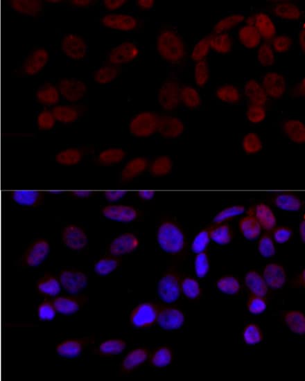 Polyclonal Rabbit anti-Human MAPK8 / JNK1 Antibody (IHC, IF, WB)