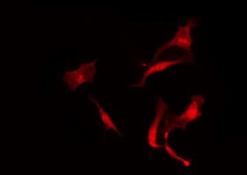 Polyclonal Rabbit anti-Human CCKBR / Cckb Antibody (IHC, IF, WB)