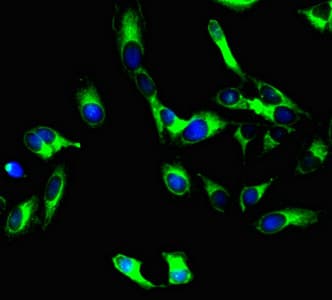 PODXL / Podocalyxin Antibody (clone 4D2G7)