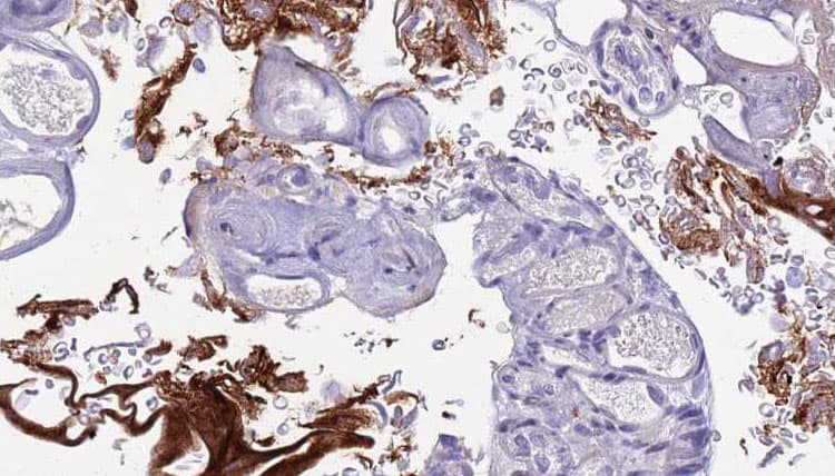 CD177 Antibody