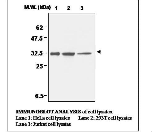 IHC-plus™ CCS Antibody (clone 1G1)