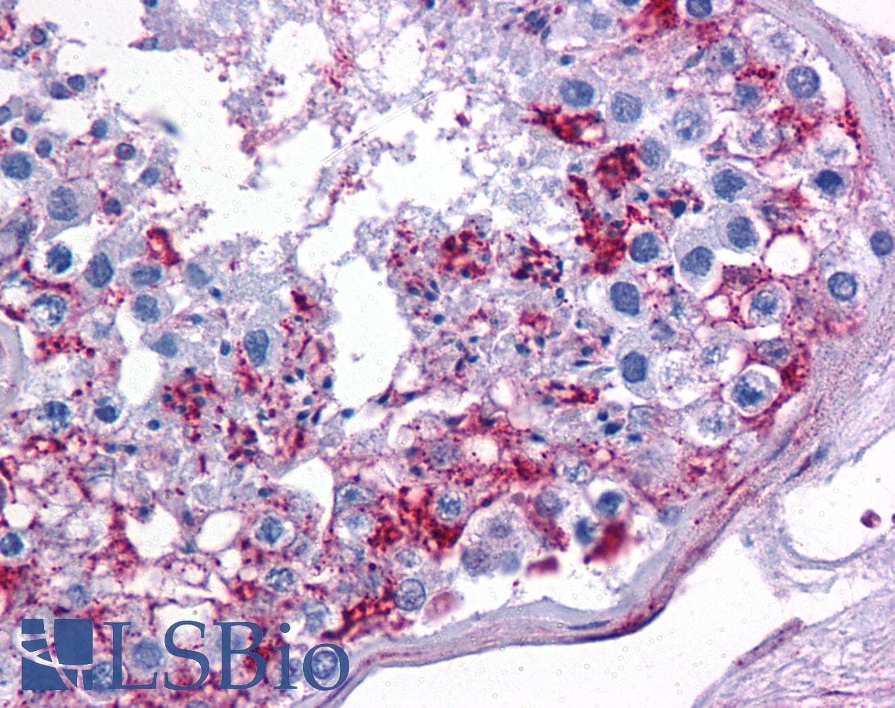 IHC-plus™ APBA2 Antibody