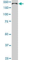 CDC42BPB / MRCKB Antibody (clone 2F4)
