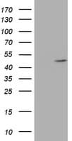 AGPAT5 Antibody (clone OTI1D4)