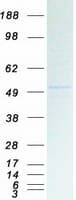 Human KCNJ5 / Kir3.4 / GIRK4 Protein (Recombinant Myc-DDK (Flag))
