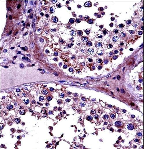 PRMT5 Antibody (aa76-104)
