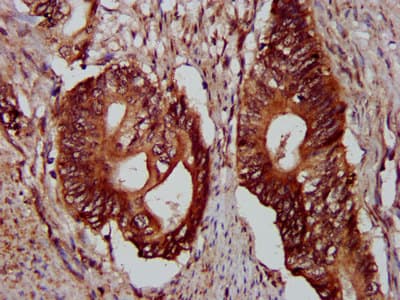 PLEC / Plectin Antibody