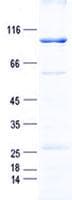 Human LIMK2 Protein (Recombinant GST, N-terminus + His, C-terminus)
