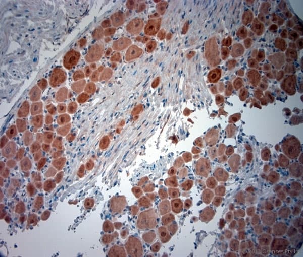 Polyclonal Rabbit anti-Human NeuN Antibody (aa80-130, IHC, WB)