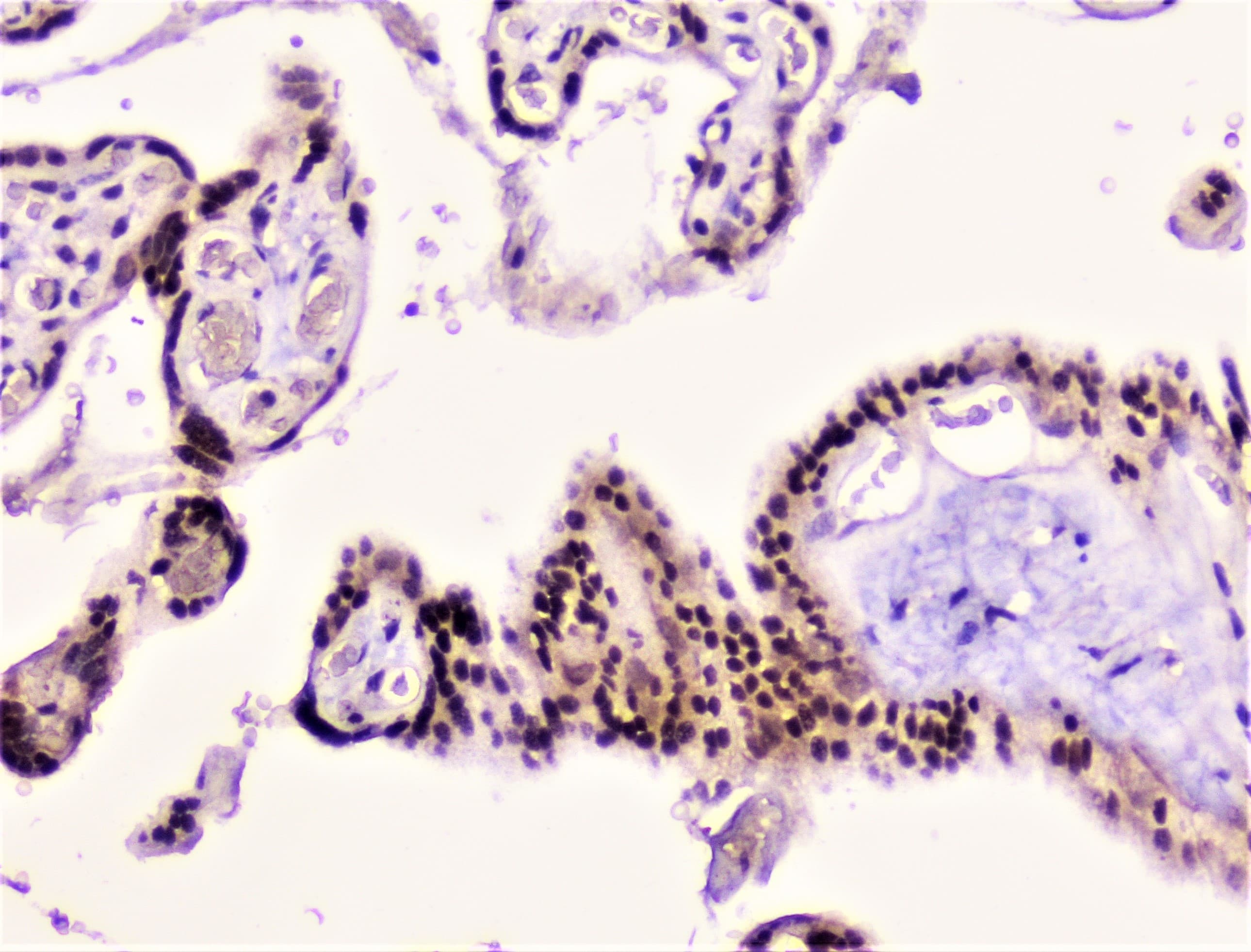RAD51 / RECA Antibody