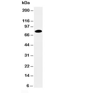 PRKCA / PKC-Alpha Antibody (C-Terminus)