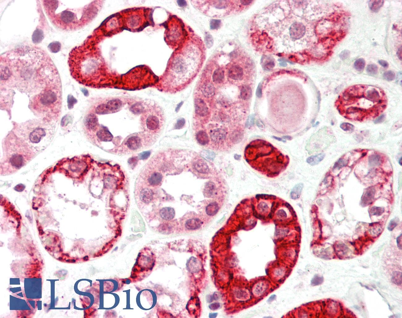 SAV1 / WW45 Antibody (aa266-315)
