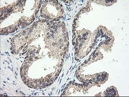 ALS2CR1 / NIF3L1 Antibody (clone OTI2B7)