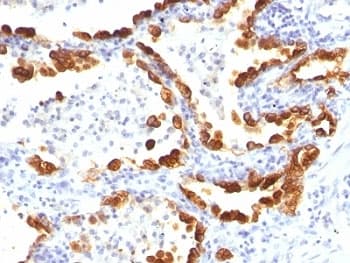 KRT18 / CK18 / Cytokeratin 18 Antibody (clone KRT18/835)