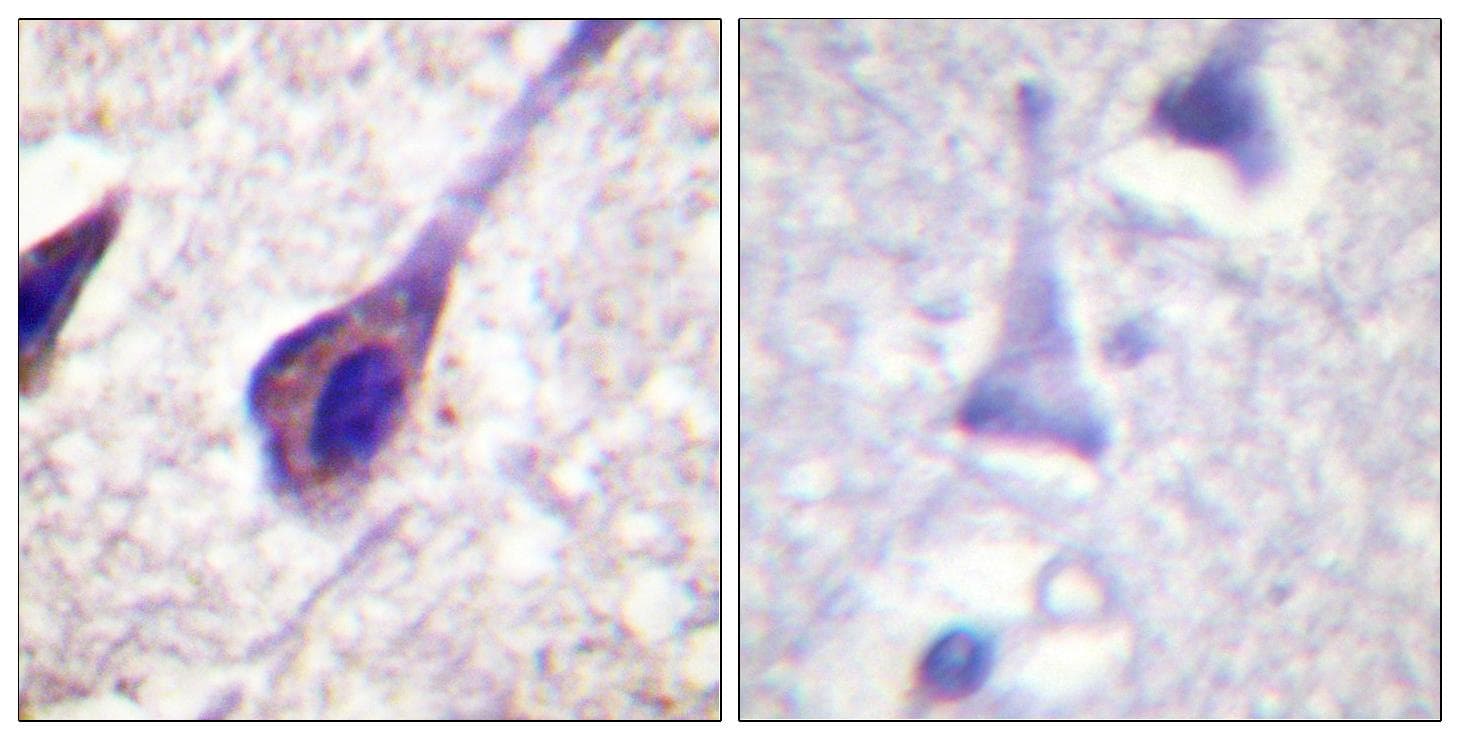 BID Antibody (p78)