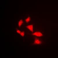 Polyclonal Rabbit anti-Human APOBEC3G / CEM15 Antibody (IHC, IF, WB)