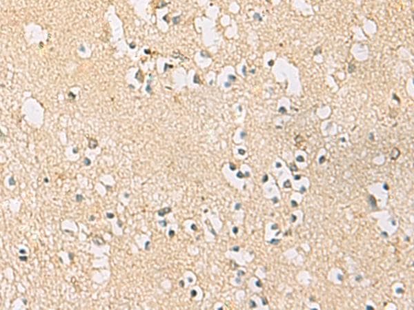 PDE4DIP / MMGL Antibody