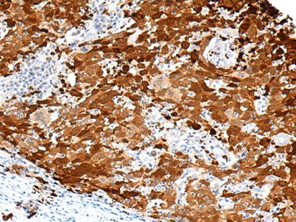 Polyclonal Rabbit anti-Human FGD3 Antibody (IHC, WB)