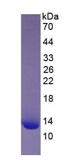 Human B2M / Beta 2 Microglobulin Protein (Recombinant)