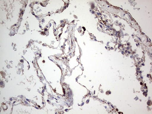 Monoclonal Mouse anti-Human PKM2 Antibody (clone 11B11, IHC, WB)