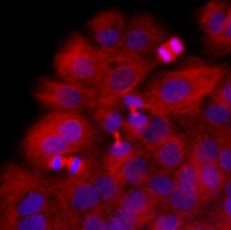 IHC-plus™ Monoclonal Mouse anti-Human TUBB / Beta Tubulin Antibody (clone AT5B2, IHC, IF, WB)
