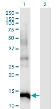 CDKN2B / p15 INK4b Antibody (clone 8C4)