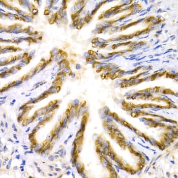 LEPR / Leptin Receptor Antibody