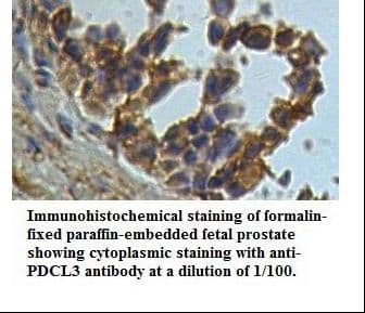 Polyclonal Rabbit anti-Human PDCL3 Antibody (IHC, WB)