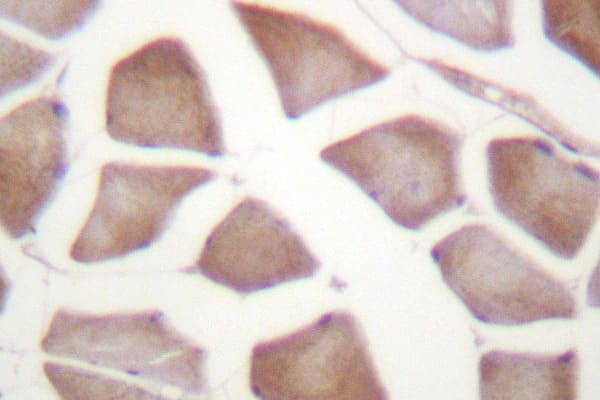 DAPK2 / DAP Kinase 2 Antibody (Arg314)