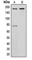 CUX1 / CASP Antibody (N-Terminus)