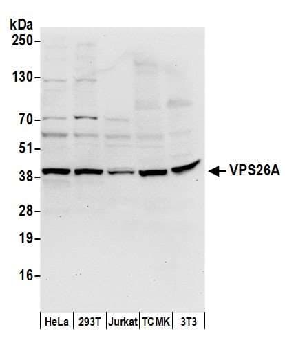 VPS26A / VPS26 Antibody (aa277-327)