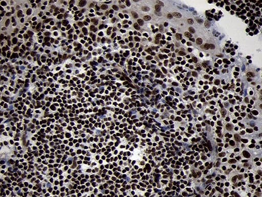 SMC1A / SMC1 Antibody (aa889-1016, clone OTI11E1)
