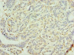 MAGEC2 / CT10 Antibody (aa1-150)