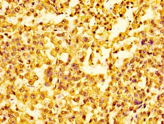 HIST1H1E Antibody